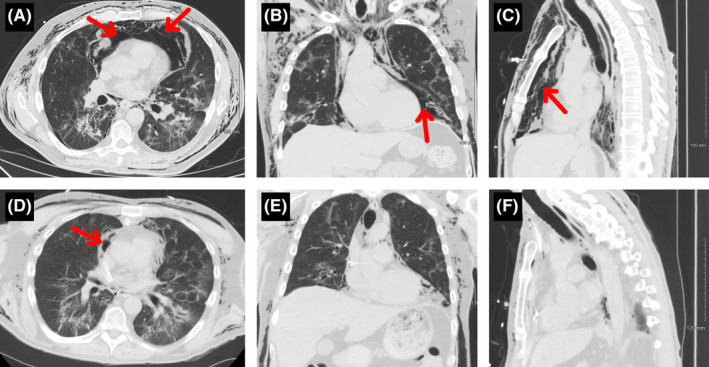 FIGURE 2