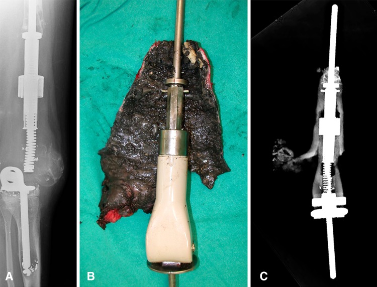 Fig. 4A–C