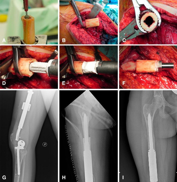 Fig. 5A–I