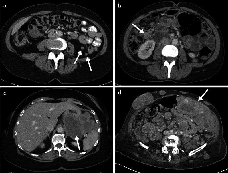 Fig. 15