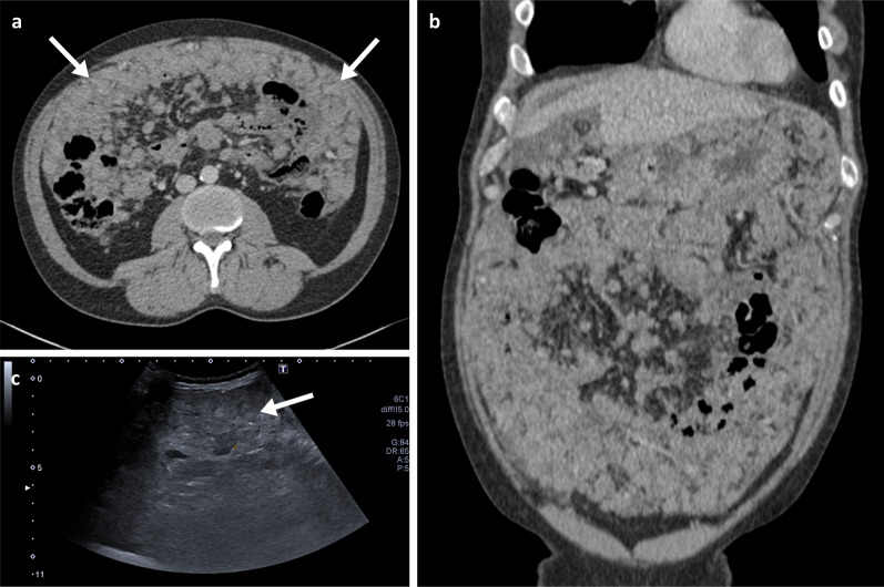 Fig. 16