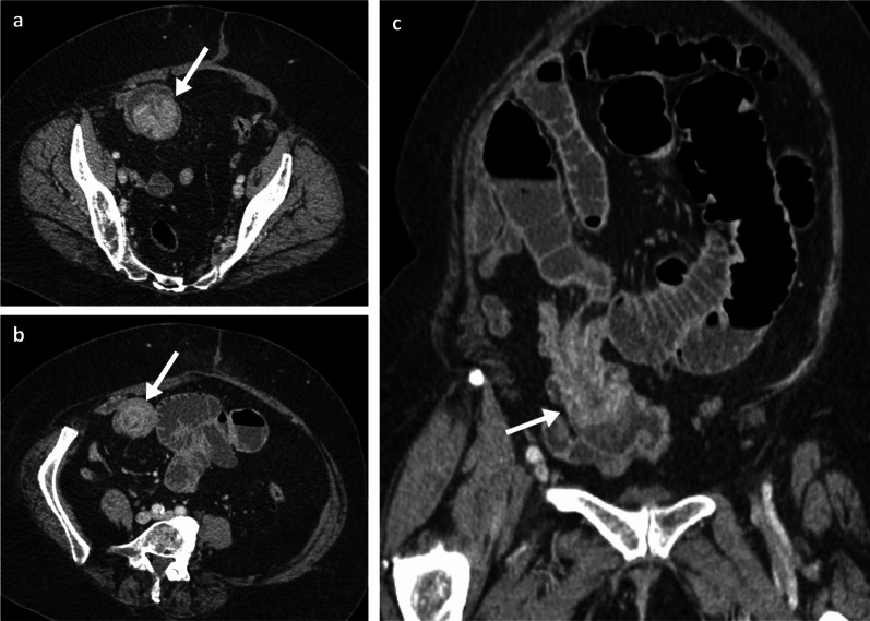 Fig. 8