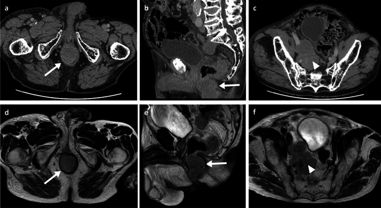 Fig. 12