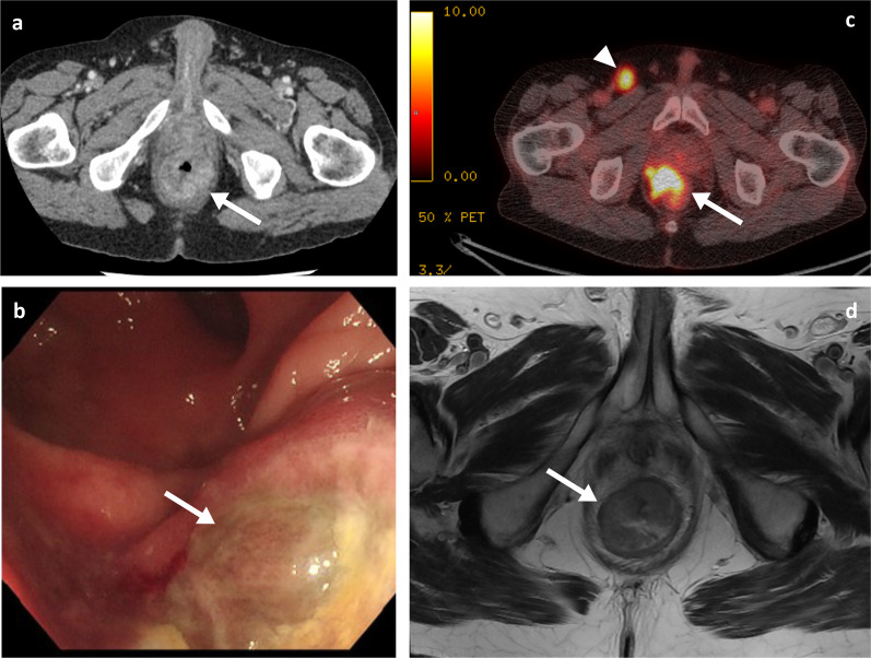 Fig. 11