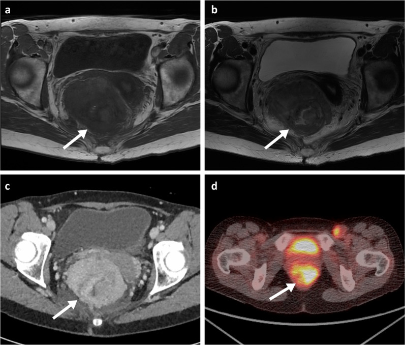 Fig. 14