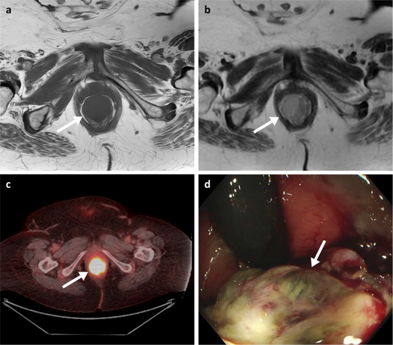 Fig. 13