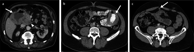 Fig. 6