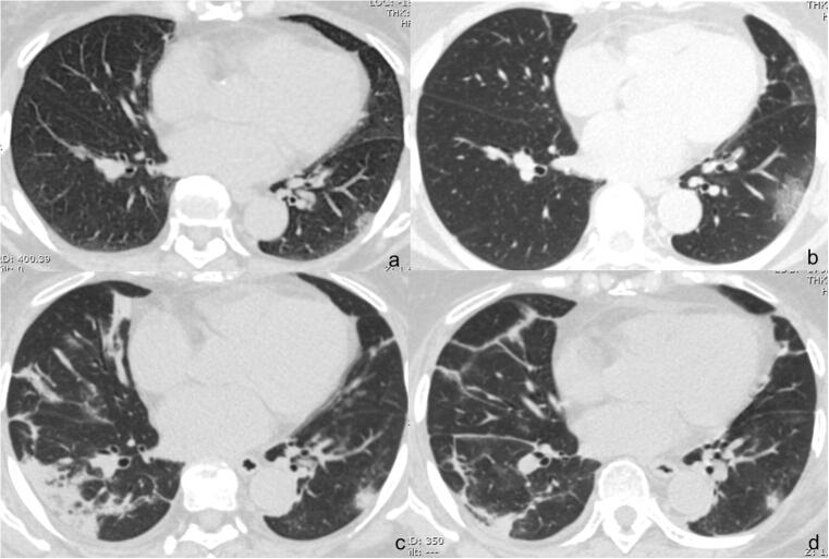 Fig. 3