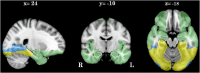 Fig 5