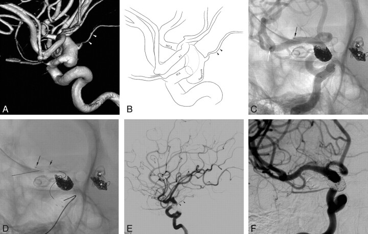 Fig 3.