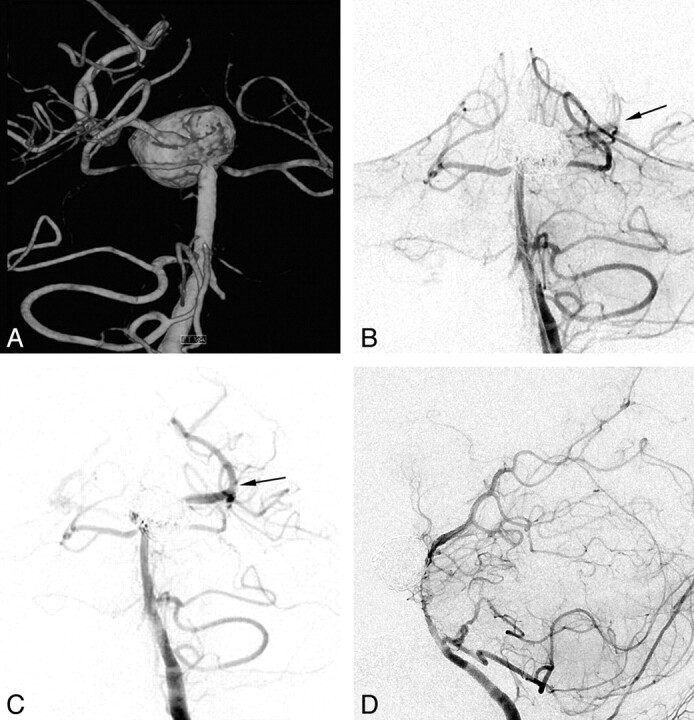 Fig 4.