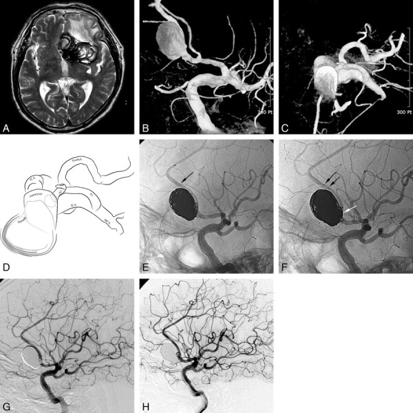 Fig 1.