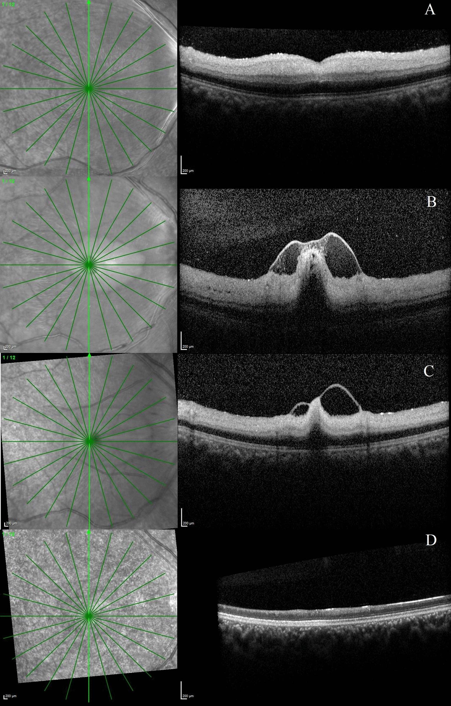 Fig. 4