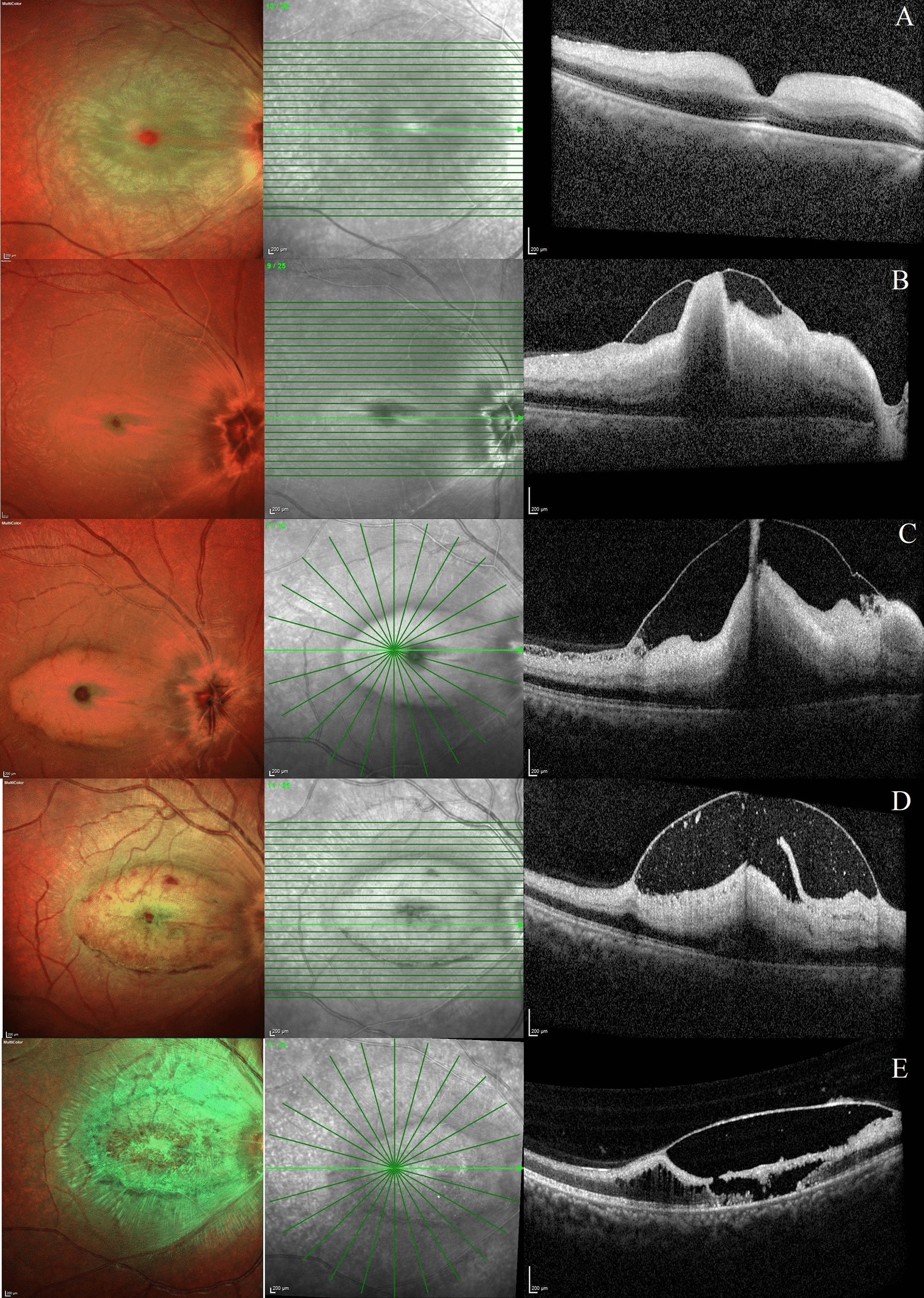 Fig. 3