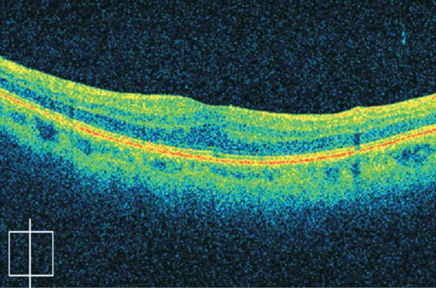 Figure 6: