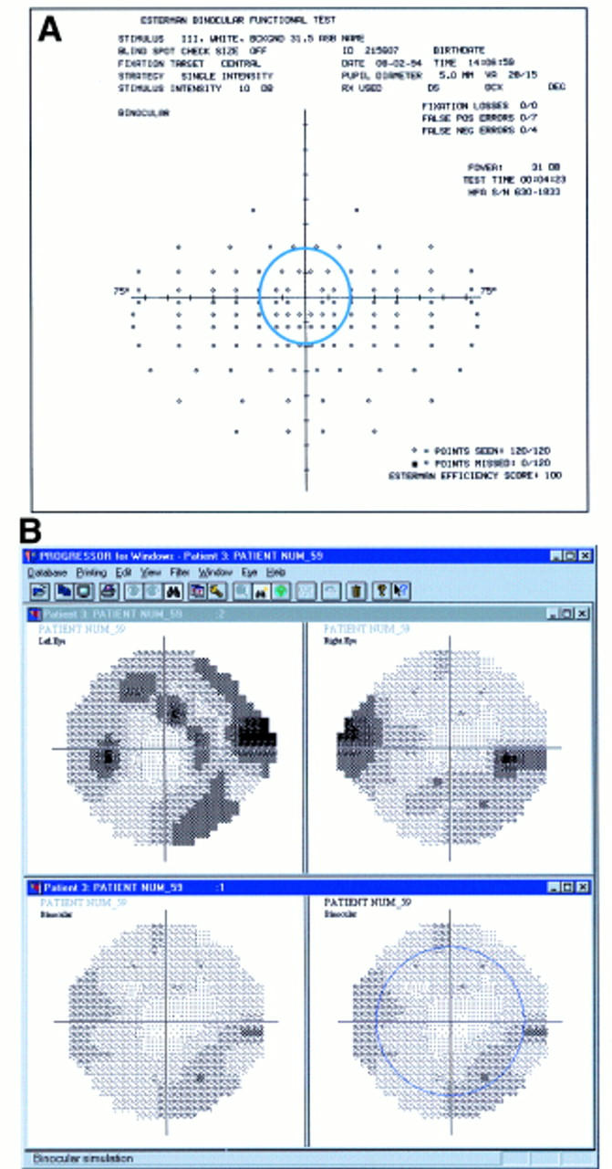 Figure 4  