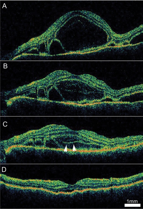 Fig. 4