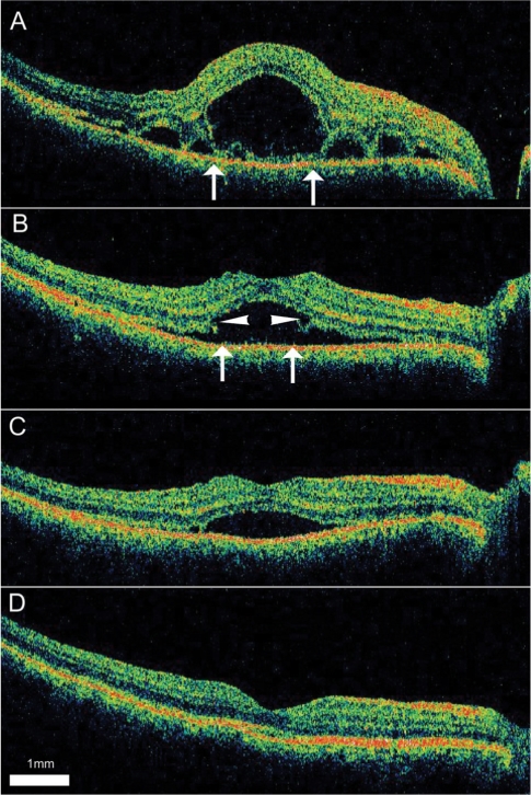 Fig. 3