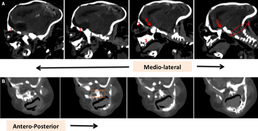 Fig. 10