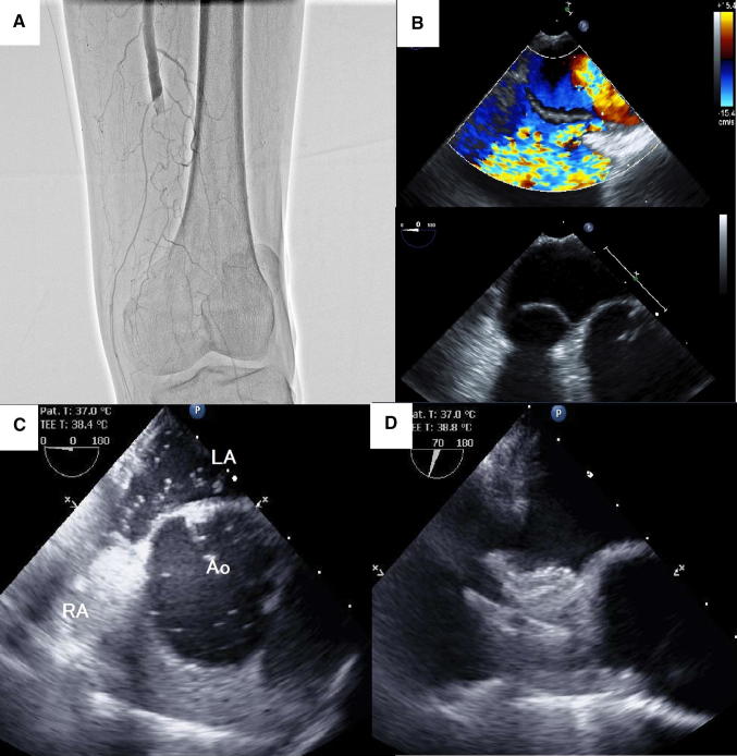 Fig. 1