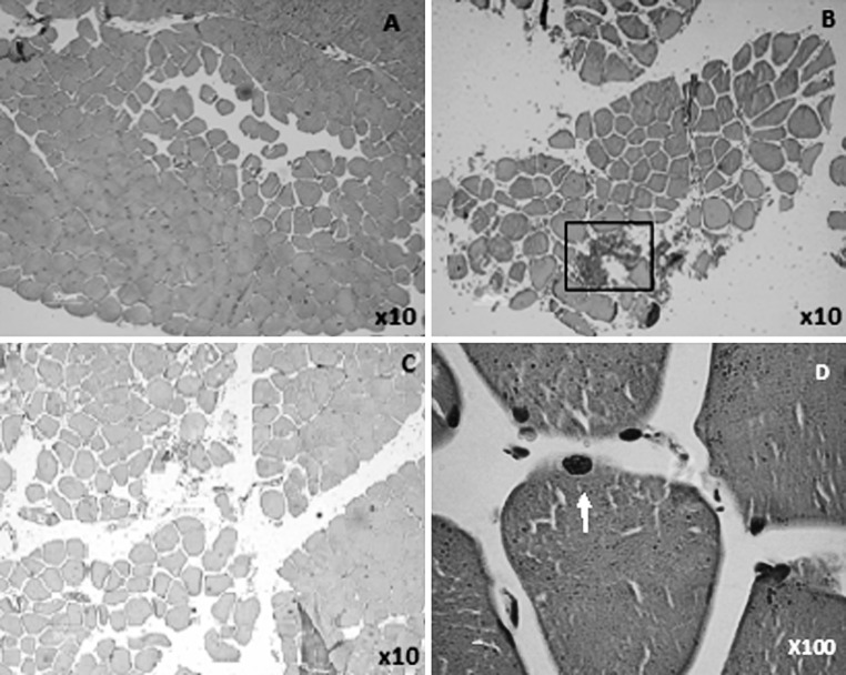 Fig. 1