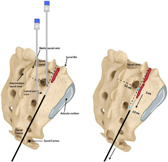 Fig. 4