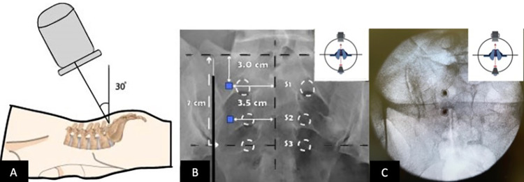 Fig. 1