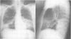 93