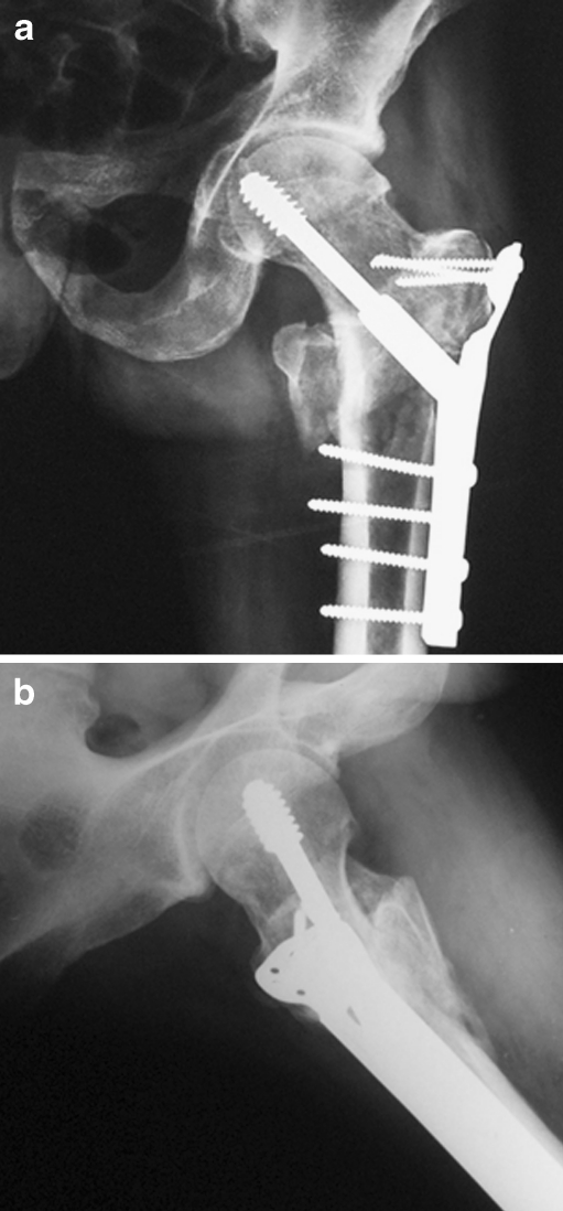 Fig. 1