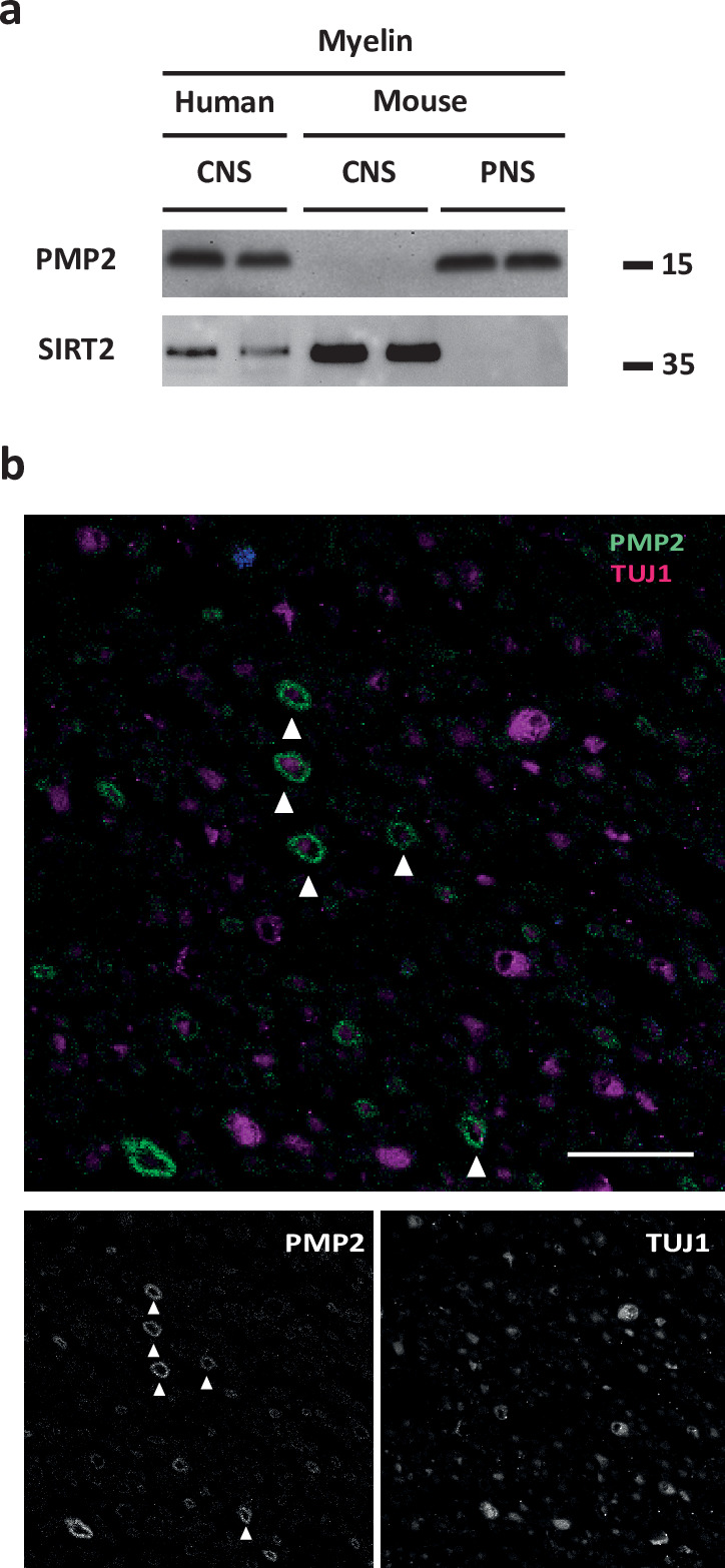 Figure 2—figure supplement 1.