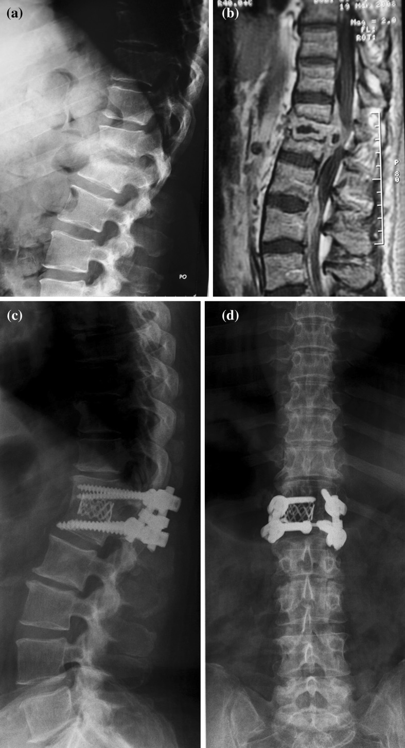  Fig. 3