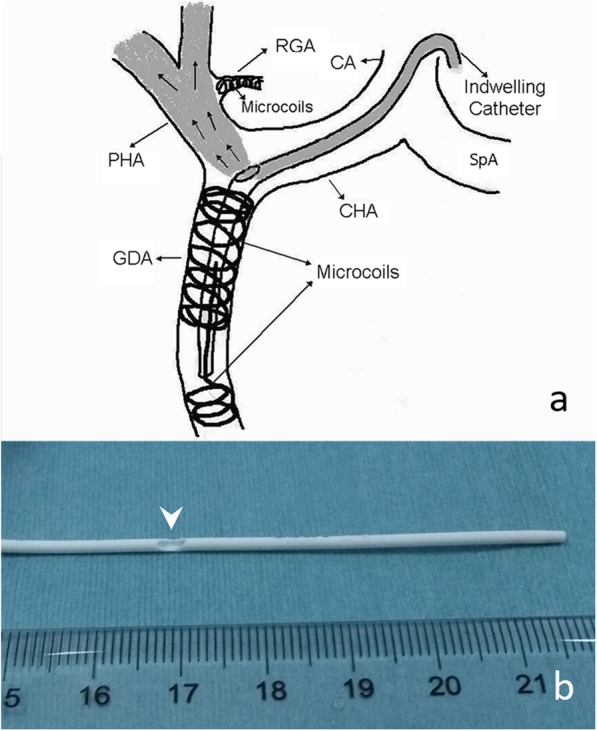 Fig.1