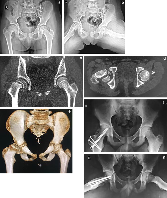 Fig. 2