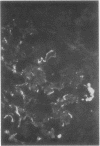 200
