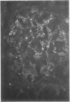 200