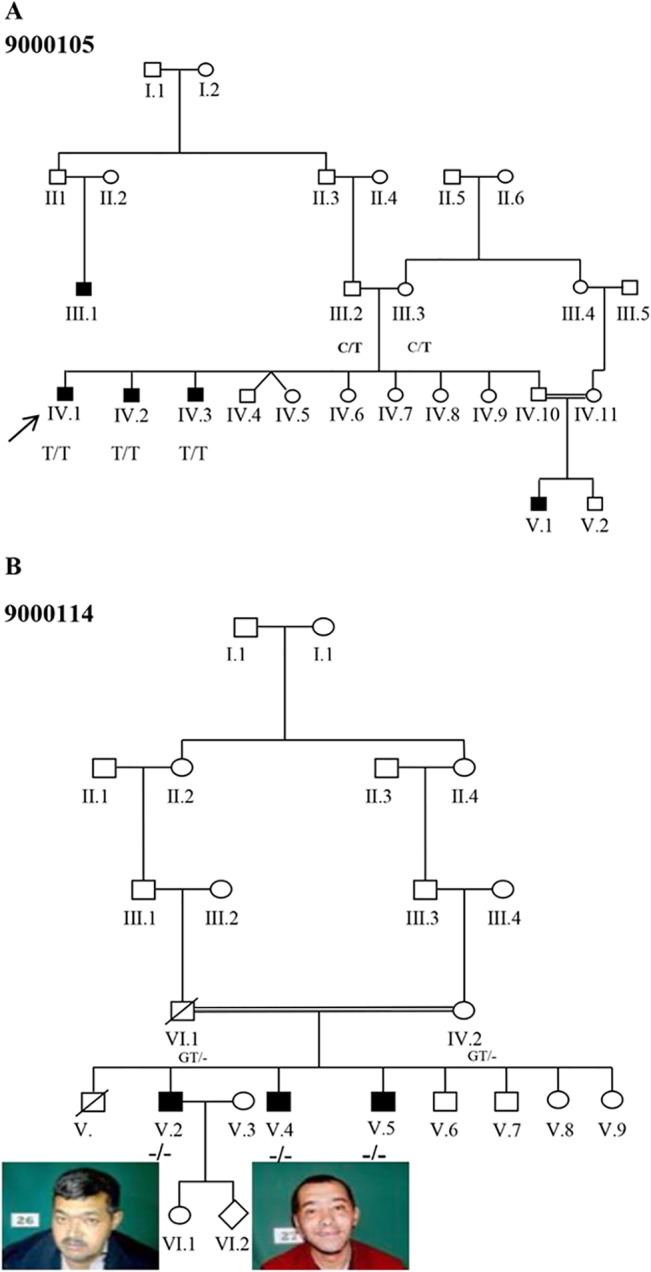 Fig 1