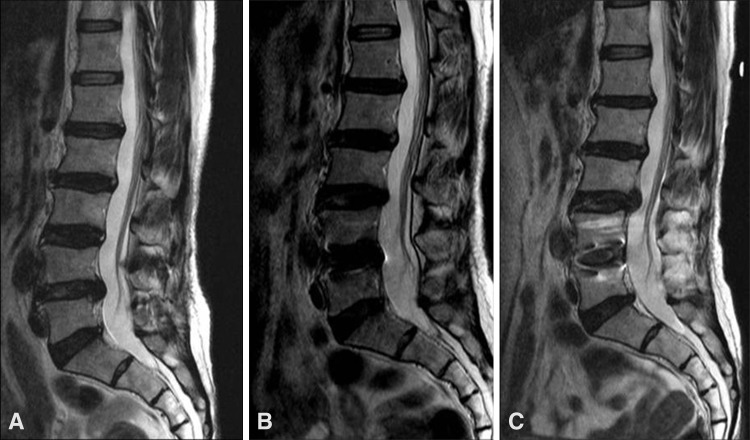 Fig. 2A–C