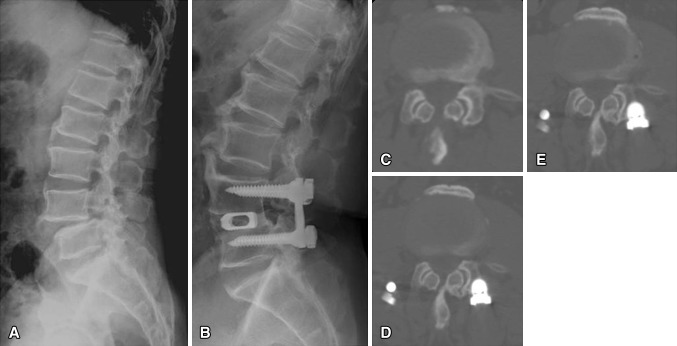 Fig. 4A–E