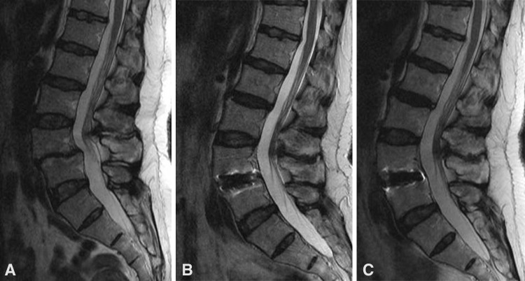 Fig. 1A–C