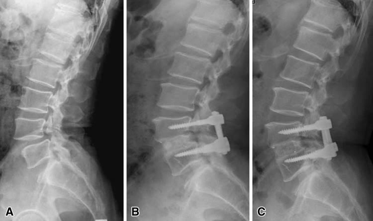 Fig. 3A–C