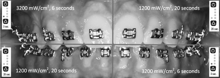 Figure 1. Split-mouth design curing protocol.