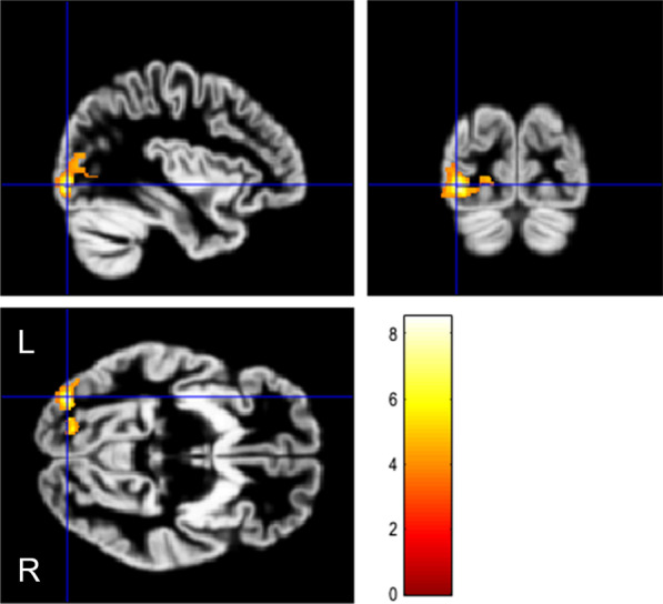 Fig. 4