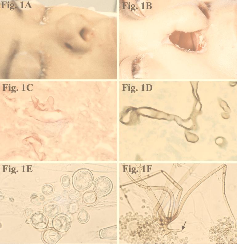 FIG. 1