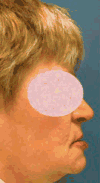 FIG. 61