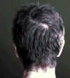 FIG. 18