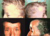 FIG. 44