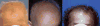 FIG. 22