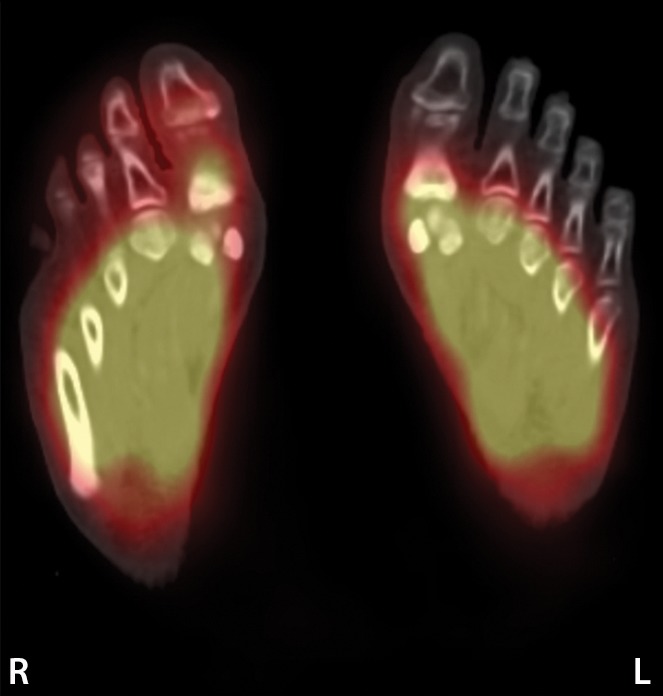 Figure 11e.