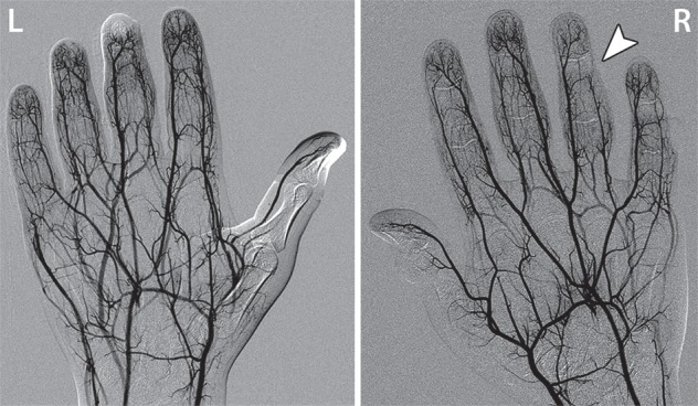 Figure 3c.