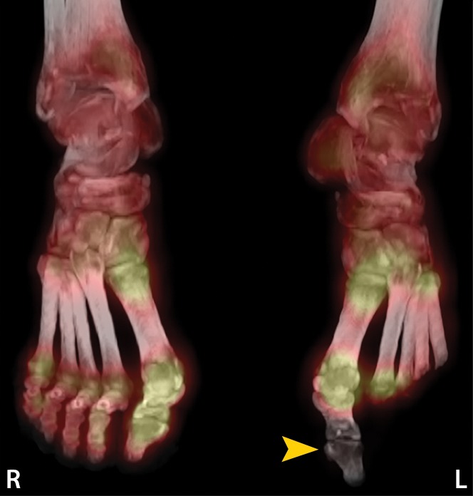 Figure 11f.